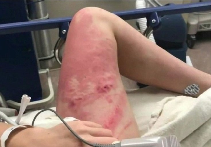 “We mogen blij zijn dat ze nog leeft”: meisje (16) van brug geduwd nadat ze aangaf dat ze niet durfde