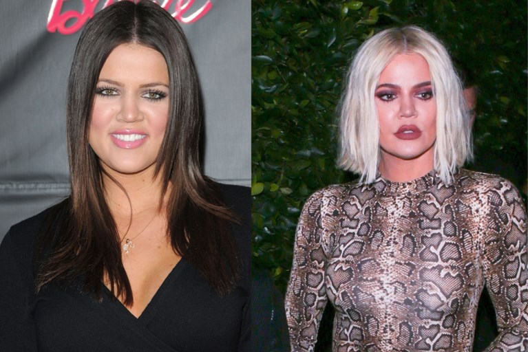 Khloé Kardashian krijgt kritiek op haar lipvergroting: “Precies een alien”