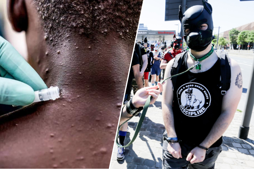 Infected cases of monkey pox linked to Antwerp fetish festival, organization itself reports (Antwerp)