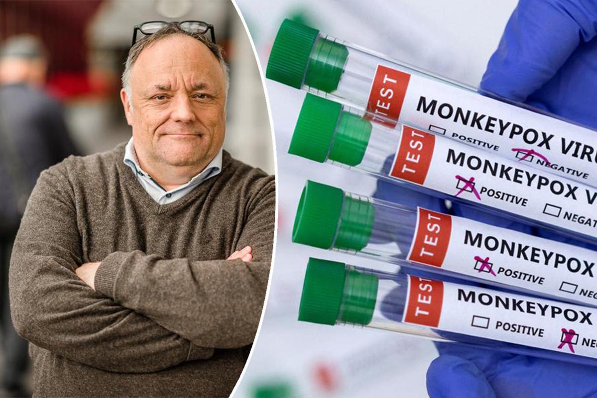 The coming days are crucial for the spread of monkeypox in Belgium: “Incubation period of the first cases is ending”