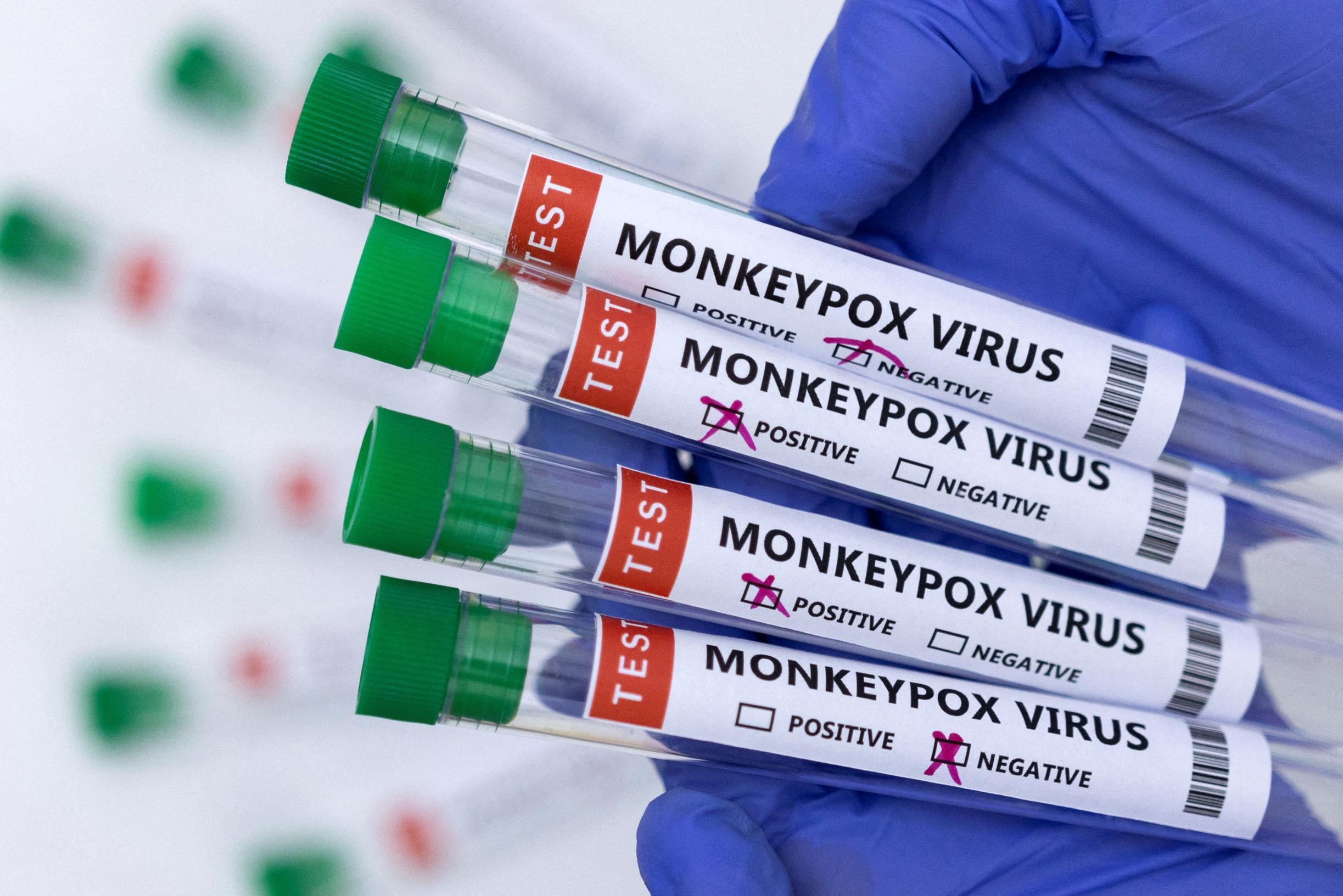 14 infections with monkeypox virus have now been established in Belgium