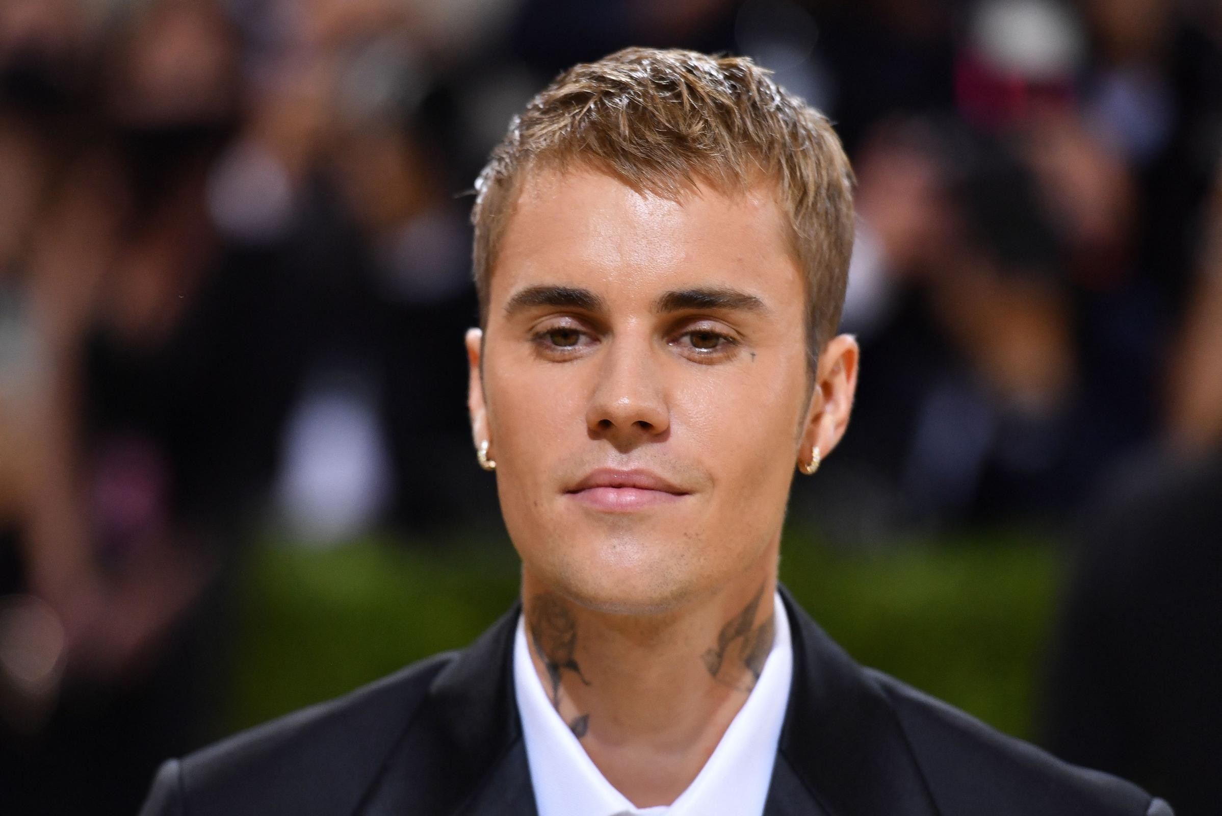 Justin Bieber è mezzo paralizzato in faccia e condivide il video con i fan: “Mi si spezza il cuore”